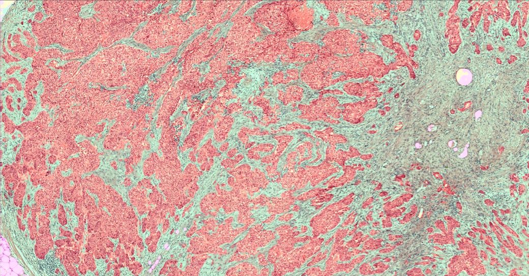 tissue scan ai filter applied