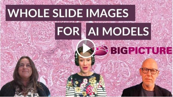 Podcast - This is Bigpicture