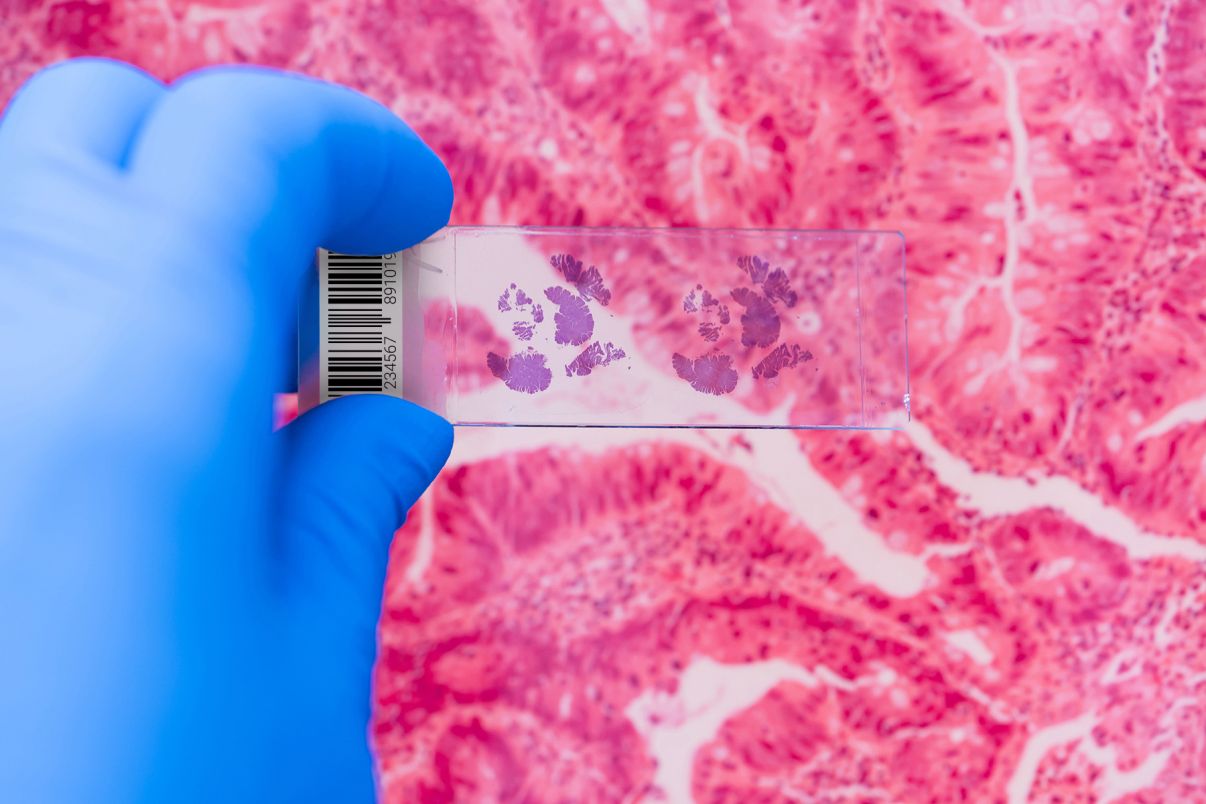 The catalyst in the digital transformation of pathology | Bigpicture